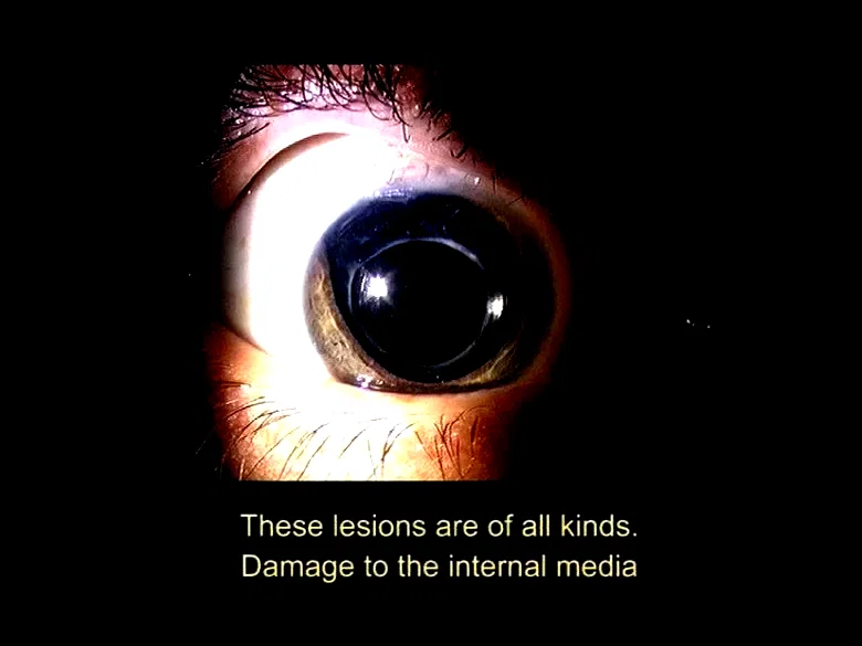 Photo 3 du film : 1/3 des yeux