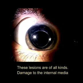 Photo du film : 1/3 des yeux