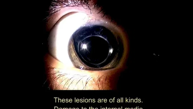 Photo 3 du film : 1/3 des yeux