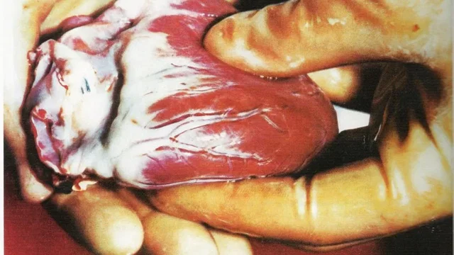 Photo du film : La nebuleuse du coeur