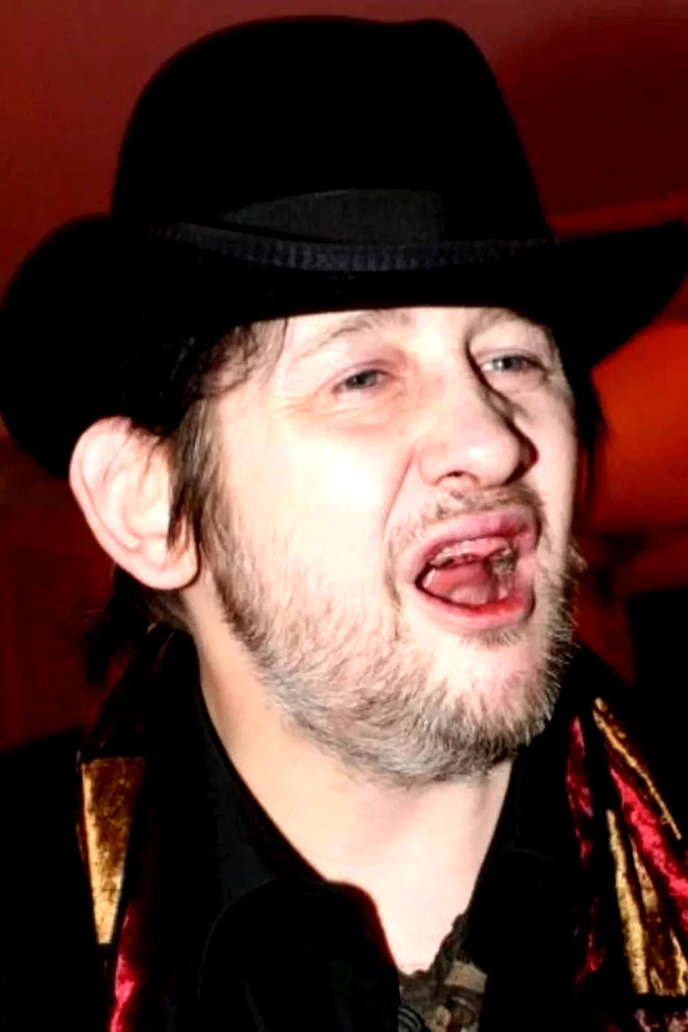 Shane MacGowan