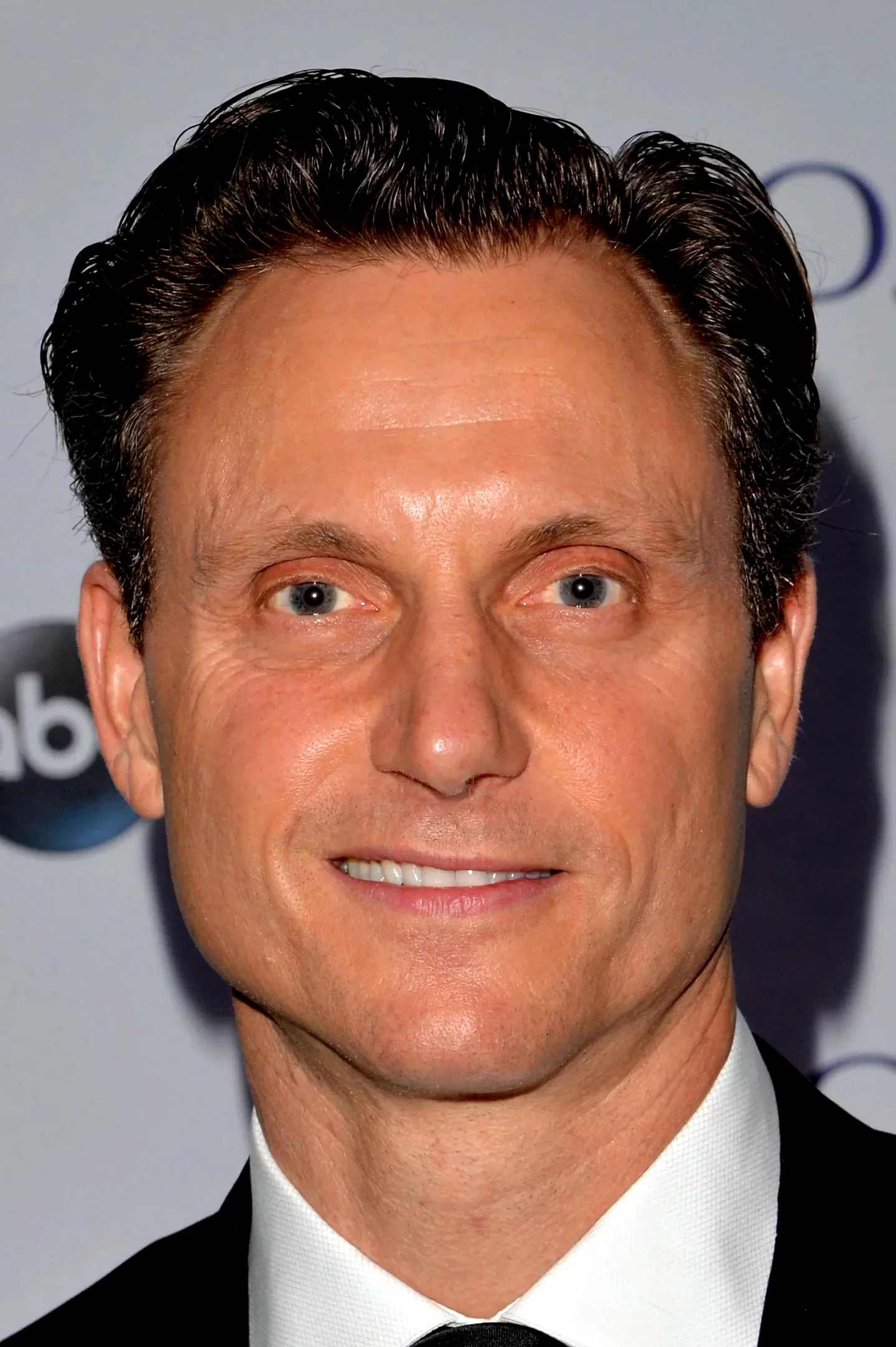 Tony Goldwyn