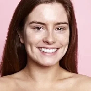 Photo star : Rachel Shenton