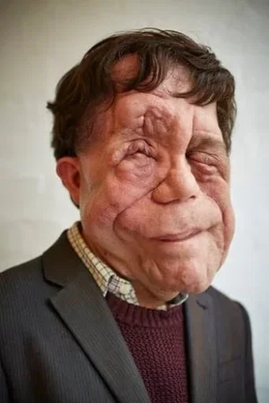  Adam Pearson photo