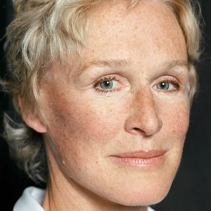 Glenn Close