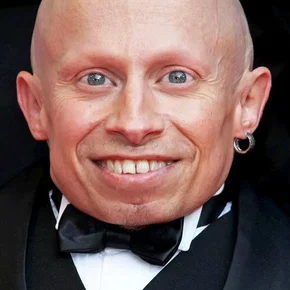 Photo star : Verne Troyer