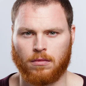 Photo star :  Pearse Egan