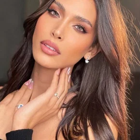 Photo star :  Talleen Abu Hanna