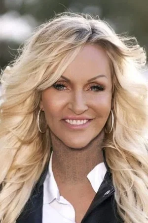  Linse Kessler