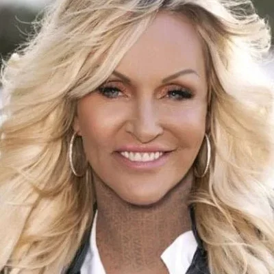  Linse Kessler