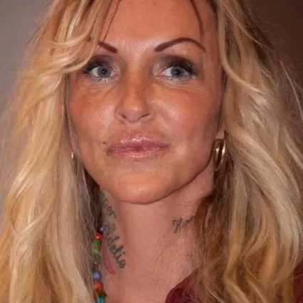  Linse Kessler