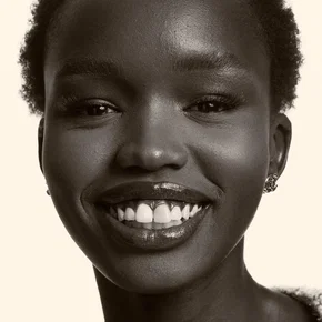 Photo star :  Anyier Anei