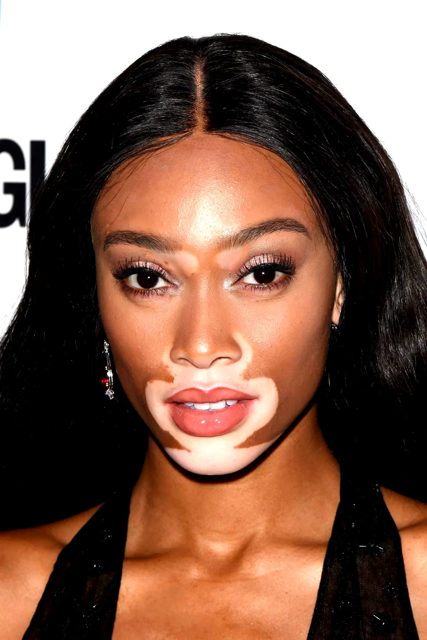  Winnie Harlow