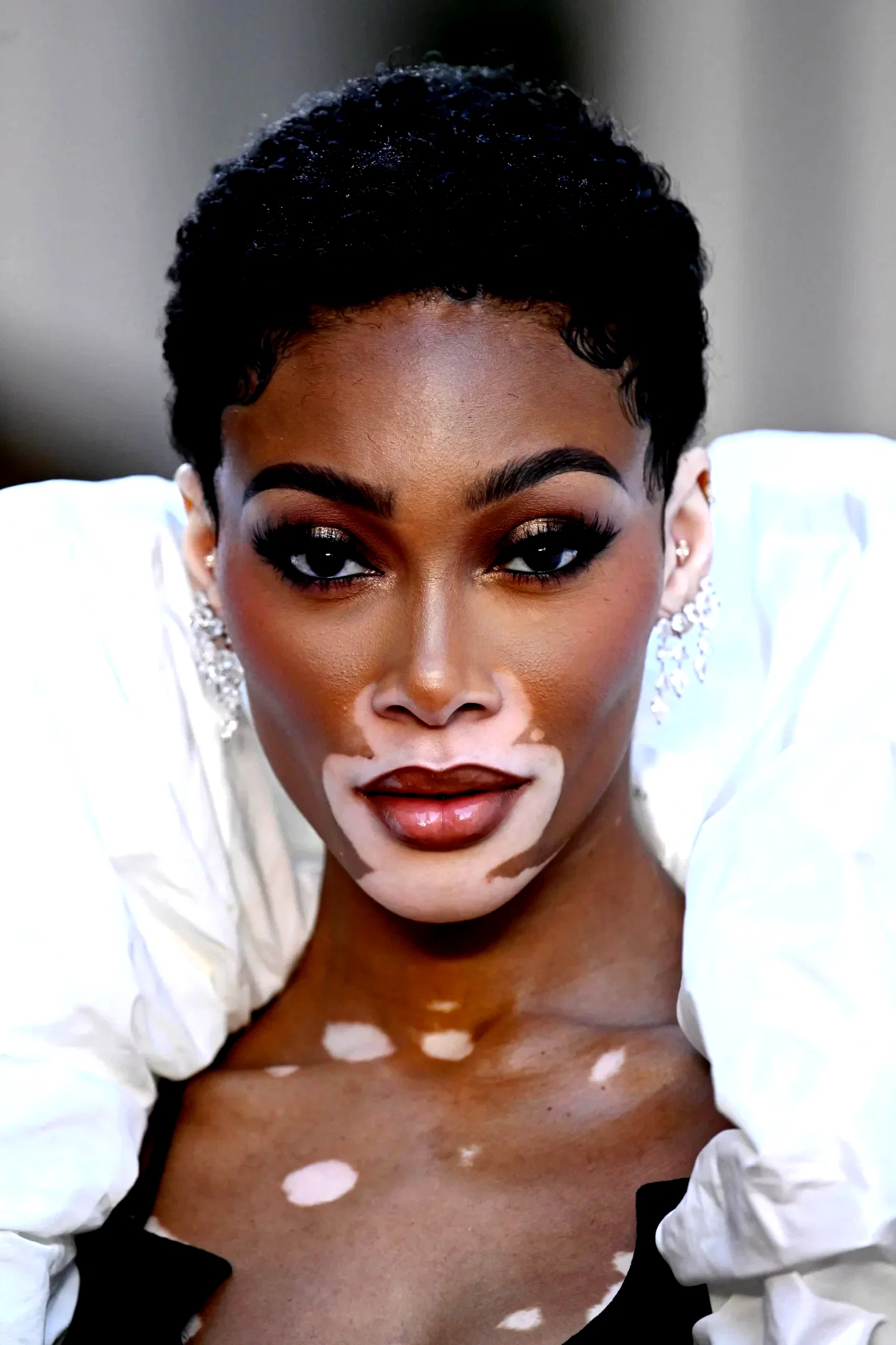  Winnie Harlow
