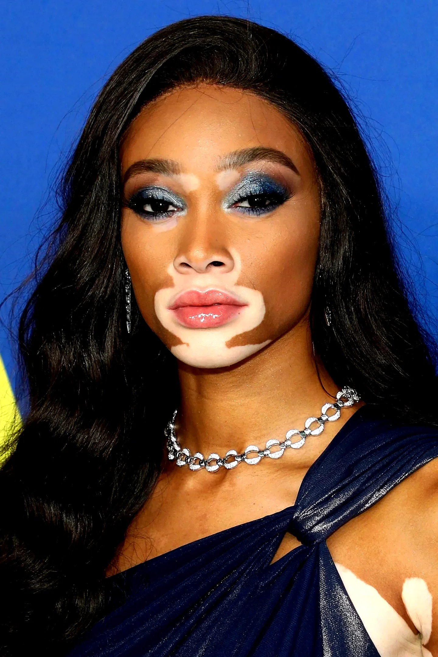  Winnie Harlow