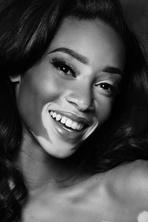  Winnie Harlow photo