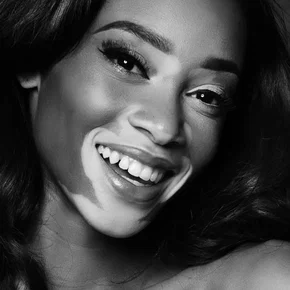 Photo star :  Winnie Harlow