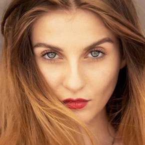 Photo star :  Uratë Shabani