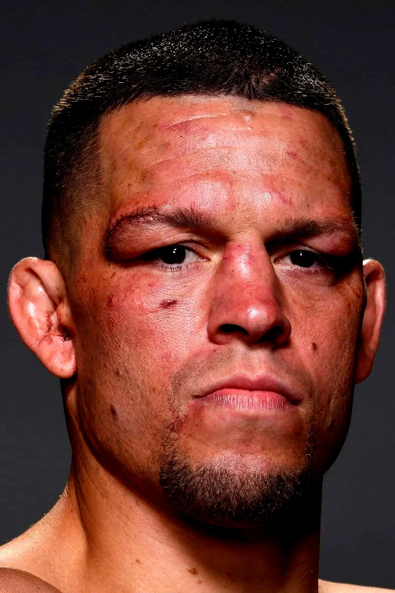  Nate Diaz