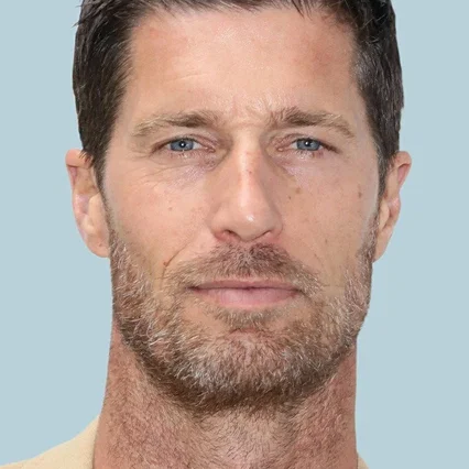  Rib Hillis