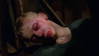 Image de Patient X (1/2)