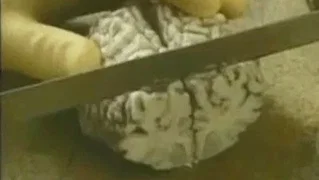 Image de Épisode 4