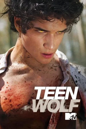 Photo 17 de la série : Teen Wolf