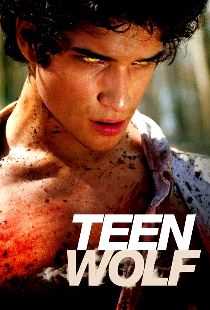 Photo 18 de la série : Teen Wolf